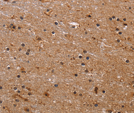 Immunohistochemistry of paraffin-embedded Human brain  tissue using FBP2 Polyclonal Antibody at dilution 1:40