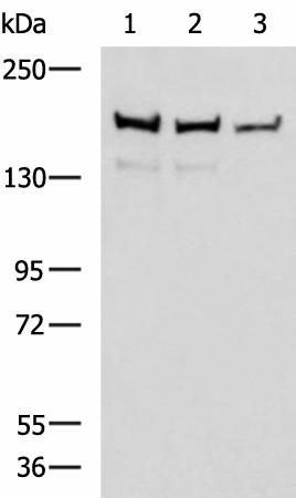 Western blot analysis of Mouse brain tissue Rat brain tissue and HepG2 cell lysates  using ROCK2 Polyclonal Antibody at dilution of 1:400