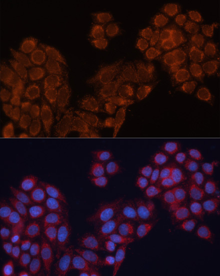 Immunofluorescence analysis of HeLa cells using ALDH6A1 Polyclonal Antibody at dilution of  1:100. Blue: DAPI for nuclear staining.