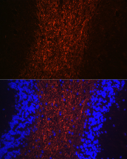 Immunofluorescence analysis of mouse brain using Neurofilament H Polyclonal antibody at dilution of 1:100 (40x lens). Blue: DAPI for nuclear staining.
