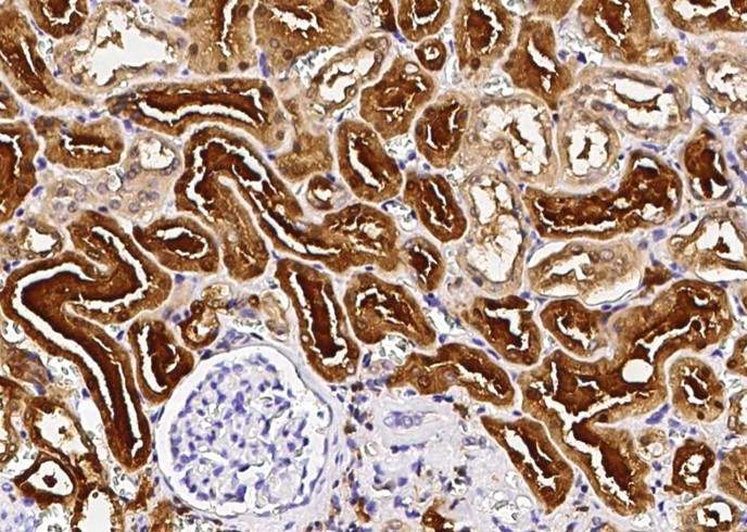 Recombinant PNP Monoclonal Antibody - small - 2