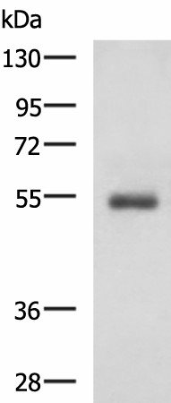 Western blot analysis of Human 2-3 grade invasive ductal breast tissue lysate  using RHCG Polyclonal Antibody at dilution of 1:600