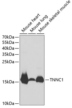 Western blot analysis of extracts of various cell lines using TNNC1 Polyclonal Antibody at 1:1000 dilution.