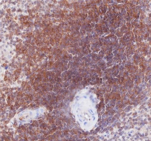 Recombinant SHIP-1 Monoclonal Antibody - 2