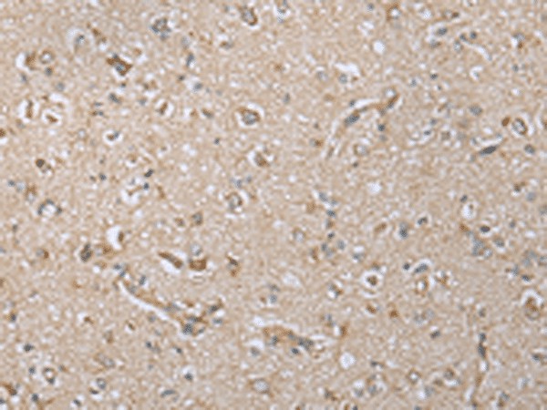 Immunohistochemistry of paraffin-embedded Human brain tissue  using NDUFA12 Polyclonal Antibody at dilution of 1:30(?200)