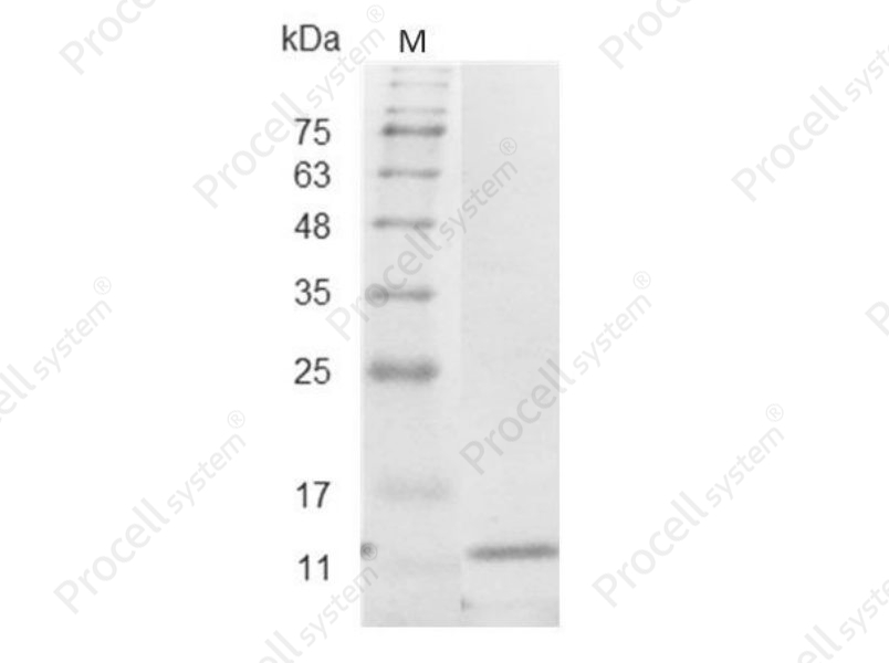 IL-5/EDF/BCDFII/TRF, Mouse, Recombinant