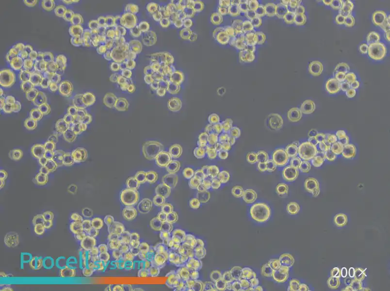 MDA-MB-453 (L15) Cell Complete Medium - 5