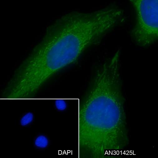 Recombinant ACADM Monoclonal Antibody - small - 2
