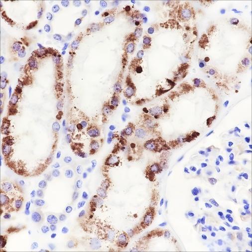 Recombinant AMACR Monoclonal Antibody - 3