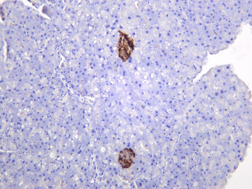 Recombinant Chromogranin A/CHGA/CGA Monoclonal Antibody - small - 5