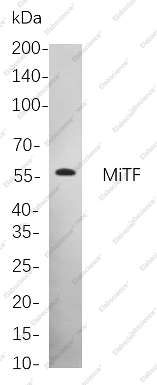 Recombinant MiTF Monoclonal Antibody - 1
