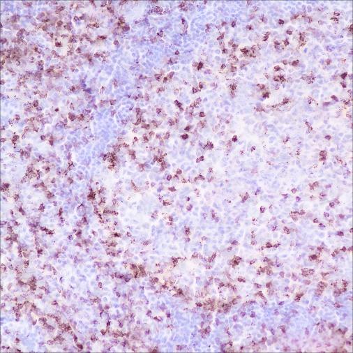Recombinant CD2 Monoclonal Antibody - small - 2