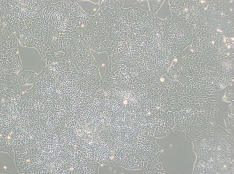 HCT-8 [HRT-18] Cell Complete Medium - 2