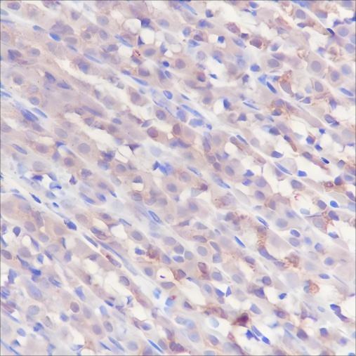 Recombinant GOT2 Monoclonal Antibody - small - 4
