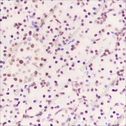 Recombinant FUBP1 Monoclonal Antibody - 3