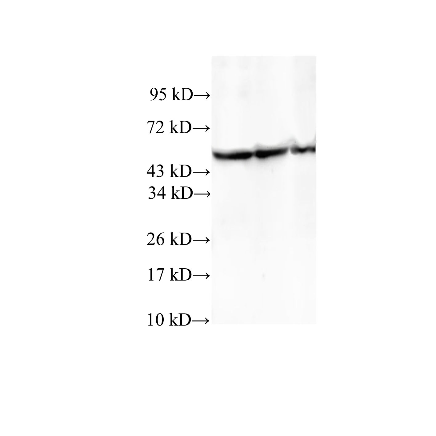 Western Blot analysis of HeLa, A549 and 293T cells using TCP1 Polyclonal Antibody at dilution of 1:600