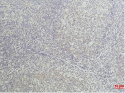 Immunohistochemical analysis of paraffin-embedded Human tonsil tissue using TNF alpha Monoclonal Antibody at dilution of 1:50.