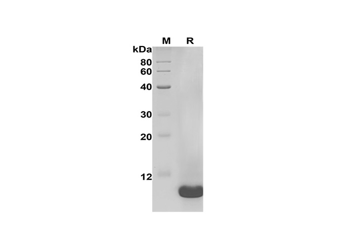 Recombinant Human MCSF Protein(GST Tag)-产品推荐-1