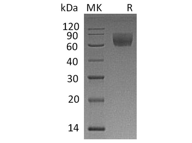Recombinant Rhesus macaque CD47/IAP Protein (Fc Tag)
