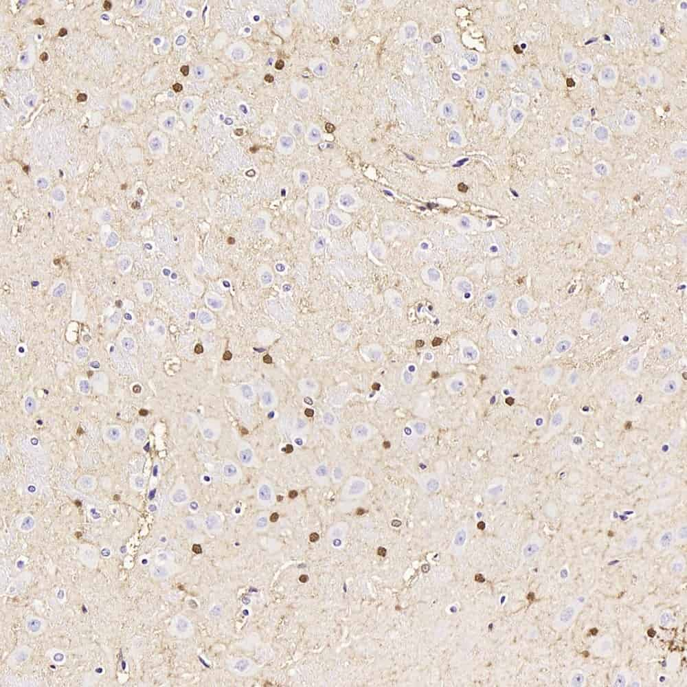 Immunohistochemistry analysis of paraffin-embedded rat brain  using S100B Polyclonal Antibody at dilution of 1:300.