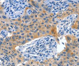 Placental Alkaline Phosphatase Polyclonal Antibody - 2