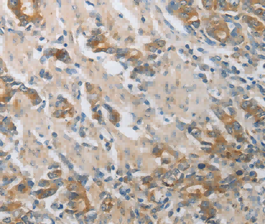 CST3 Polyclonal Antibody - 2