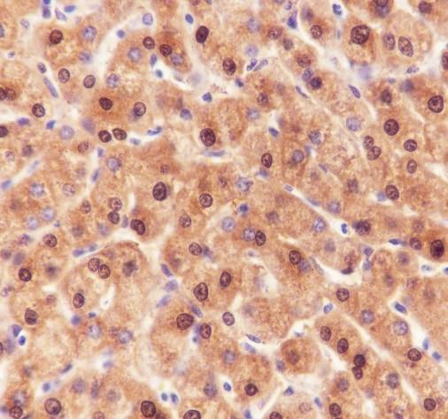 Recombinant ADK Monoclonal Antibody - 3