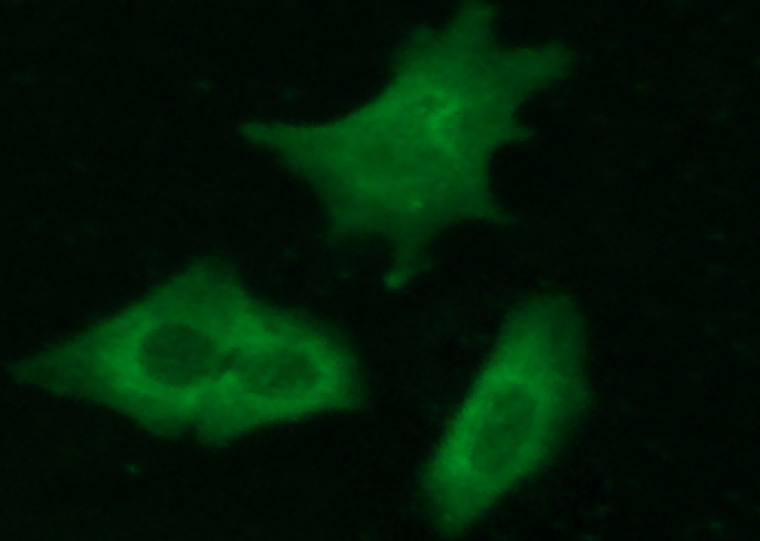 Recombinant Complexin-2/CPLX2 Monoclonal Antibody - small - 2
