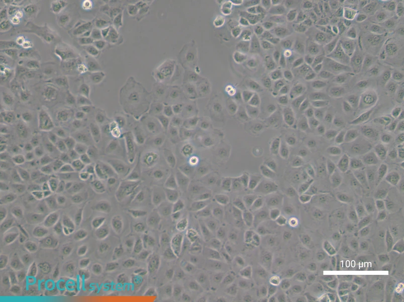 NIH:OVCAR-3 [OVCAR3] - 1