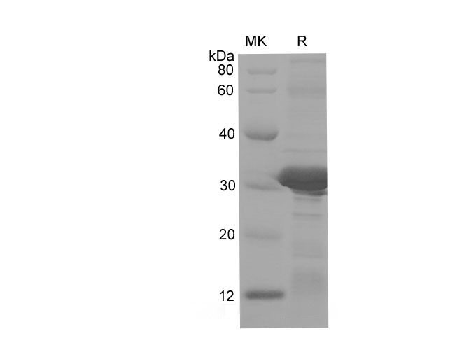 Recombinant Human IL15 Protein-产品推荐-1
