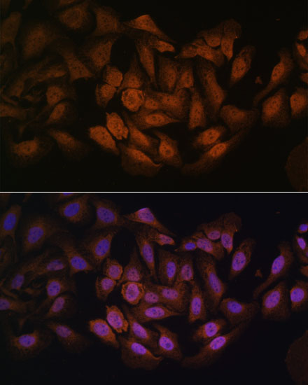 Immunofluorescence analysis of U-2 OS cells using CNBP Polyclonal Antibody at dilution of  1:100. Blue: DAPI for nuclear staining.