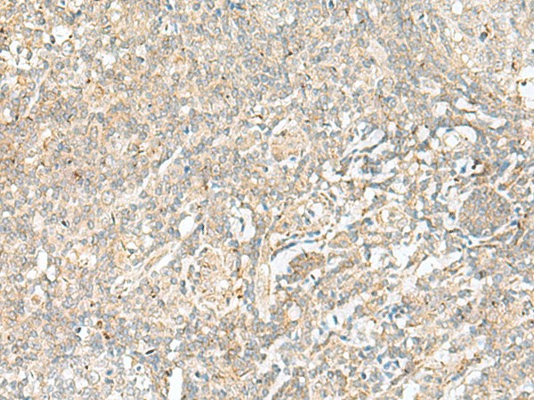 Immunohistochemistry of paraffin-embedded Human tonsil tissue  using BEX2 Polyclonal Antibody at dilution of 1:45(?200)