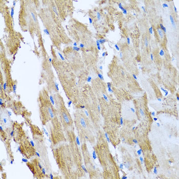 Immunohistochemistry of paraffin-embedded Rat heart using CCM2 Polyclonal Antibody at dilution of 1:100 (40x lens).