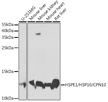 Western blot analysis of extracts of various cell lines using HSPE1/HSP10/CPN10 Polyclonal Antibody at 1:1000 dilution.