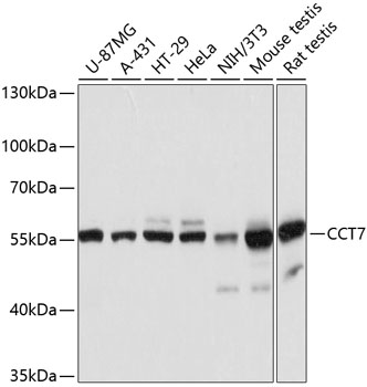 Western blot analysis of extracts of various cell lines using CCT7 Polyclonal Antibody at dilution of 1:3000.