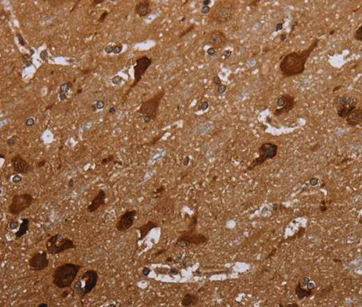 Immunohistochemistry of paraffin-embedded Human brain  tissue using MAGEC2 Polyclonal Antibody at dilution 1:40