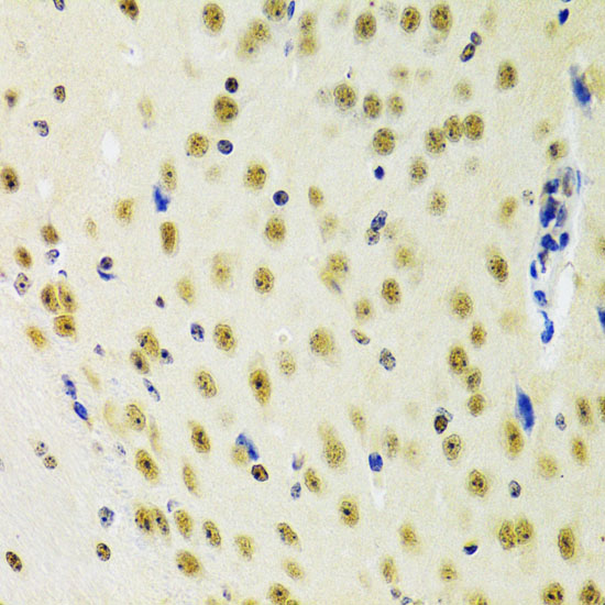 Immunohistochemistry of paraffin-embedded Mouse brain using PRPF3 Polyclonal Antibody at dilution of 1:100 (40x lens).