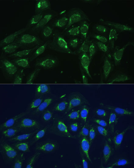 Immunofluorescence analysis of U-2 OS cells using COX6A1 Polyclonal Antibody at dilution of  1:100 (40x lens). Blue: DAPI for nuclear staining.