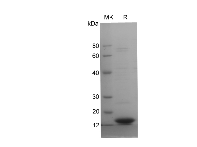 Recombinant Human IFNA2 Protein(Gst Tag)-产品推荐-1