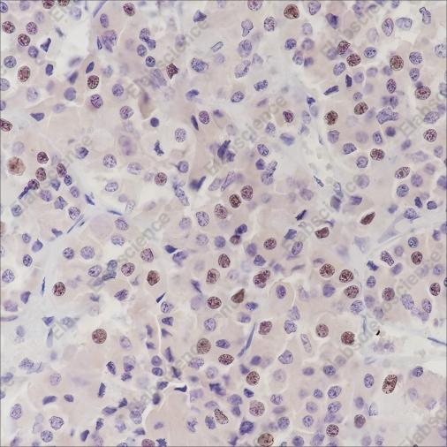 Recombinant PITX2/RGS Monoclonal Antibody - 1