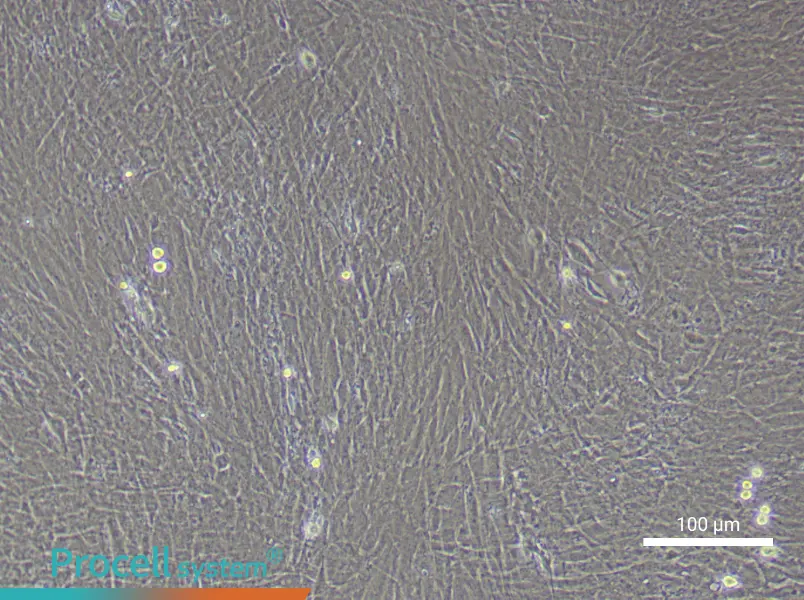 Mouse Mesenteric Smooth Muscle Cell Complete Medium - 3