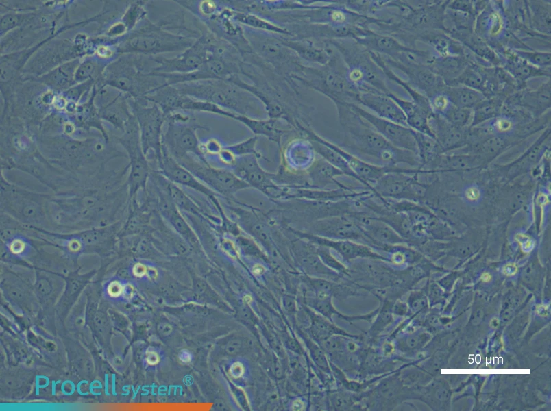 Mouse Periodontal Ligament Fibroblasts - 5