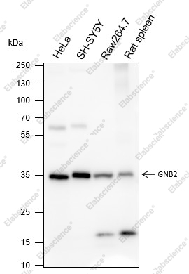 Recombinant GNB2 Monoclonal Antibody - 1