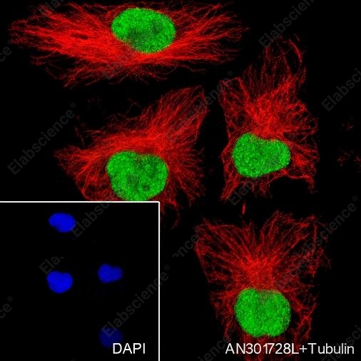 Recombinant DNMT1 Monoclonal Antibody - 4