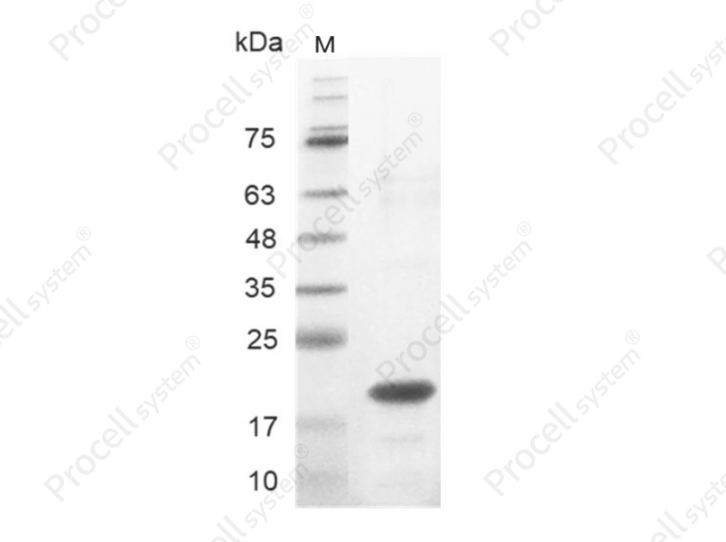 IL-33/IL-1F11, Human, Recombinant