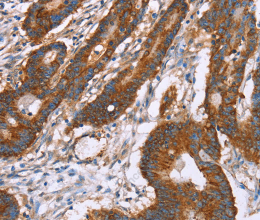 CLP36 Polyclonal Antibody - 2