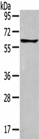 Western Blot analysis of Jurkat cells using GLP2R Polyclonal Antibody at dilution of 1:400