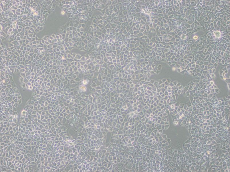 KYSE-510 Cell Complete Medium - 3