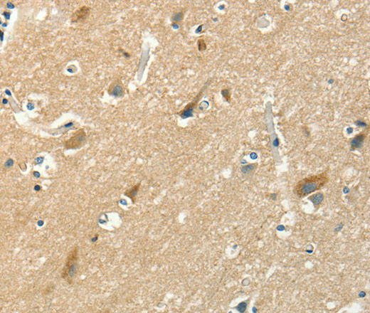 Immunohistochemistry of paraffin-embedded Human brain using ASAH2 Polyclonal Antibody at dilution of 1:50