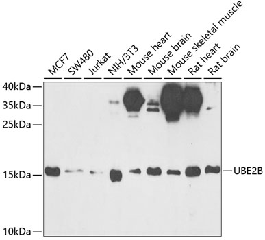 Western blot analysis of extracts of various cell lines using UBE2B Polyclonal Antibody at 1:1000 dilution.